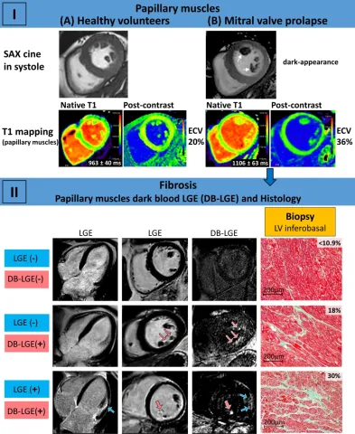 DOI: 10.1007/s10554-023-02985-w