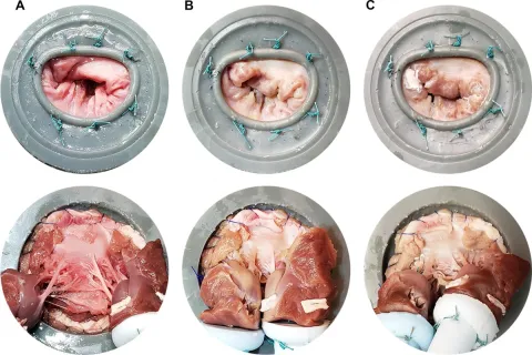 DOI: 10.1007/s13239-022-00641-3