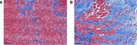 DOI: 10.3389/fcvm.2023.1057986