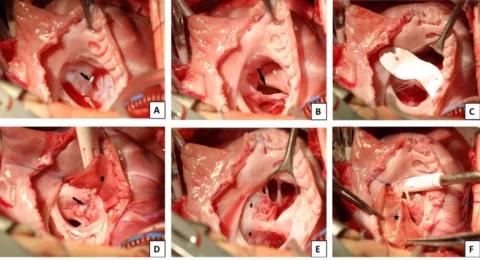 DOI: 10.1186/s13019-023-02355-6