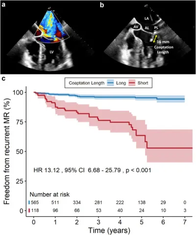 DOI: 10.1016/j.shj.2022.100152